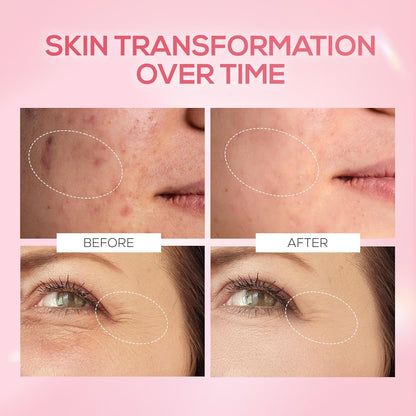 RENEE Pink Therapy PDRN Pink Peptide Face Serum For Glowing, Radiant Skin | Hydrates, Boosts Collagen, Evens Skin Tone | Lightweight, Quick Absorbing | Hyaluronic Acid & Niacinamide Infused | 30 ml