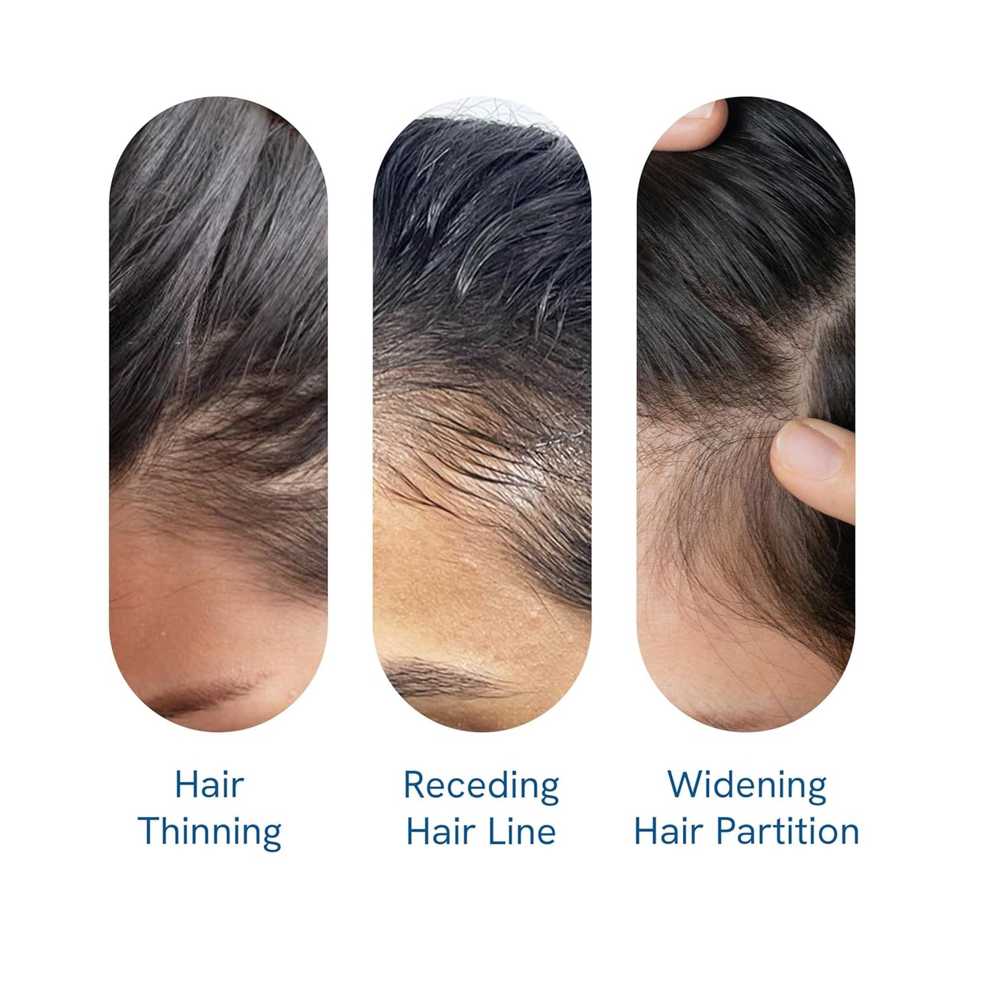 Be Bodywise Rosemary Hair Growth Serum (Roll On) | 3% Redensyl & 2% Anagain | Hair fall control serum for Women & Men | Promotes Hair Growth & Stimulates Hair Follicles | For All Hair Types | 25ml