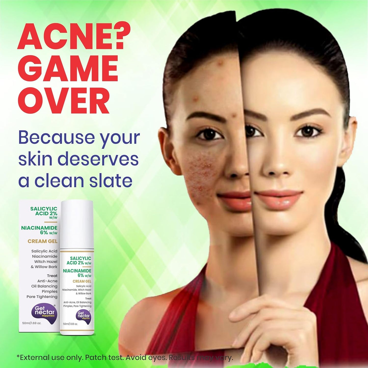 Get Nectar Happiness 2% Salicylic Acid 6% Niacinamide Acne Treatment Gel with Oil-Free for Active Acne, Pimples Oil Balancing, Pore Tightening & Brightens and Smoothens 50ml