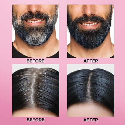 RENEE Cover-Up Hair Powder - Black | Covers Grey Roots & Bald Spots Instantly | Highly Pigmented, Fuller & Denser Look | Long-Lasting | Matte Finish | Fine Powder | Flawless Application | 4gm