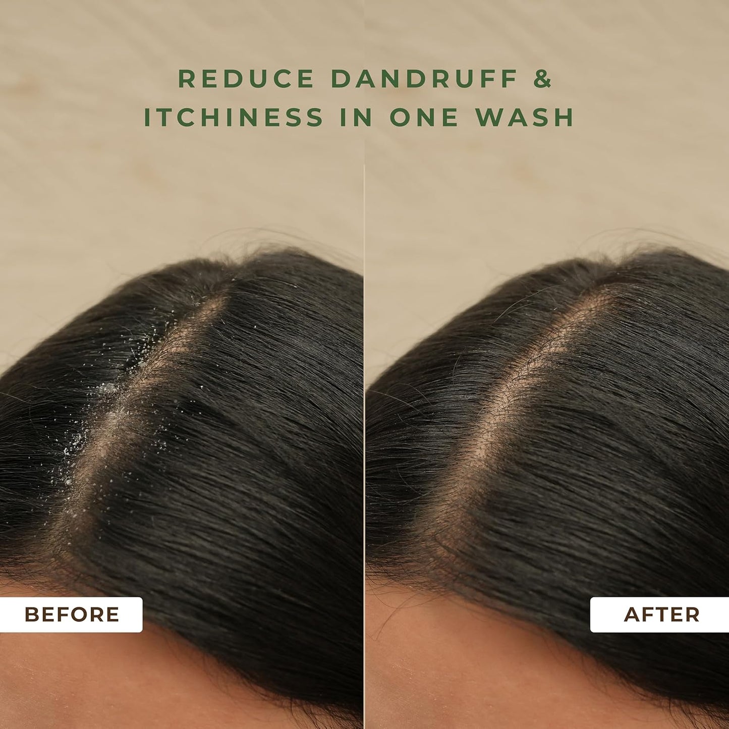 Naturali Australian Tea Tree Non-Drying Dandruff Defence Shampoo 200 ml | Removes Dandruff from Source | Soothes Itching, Irritation | Strong & Smooth Hair | For Men & Women | No Sulphate No Paraben