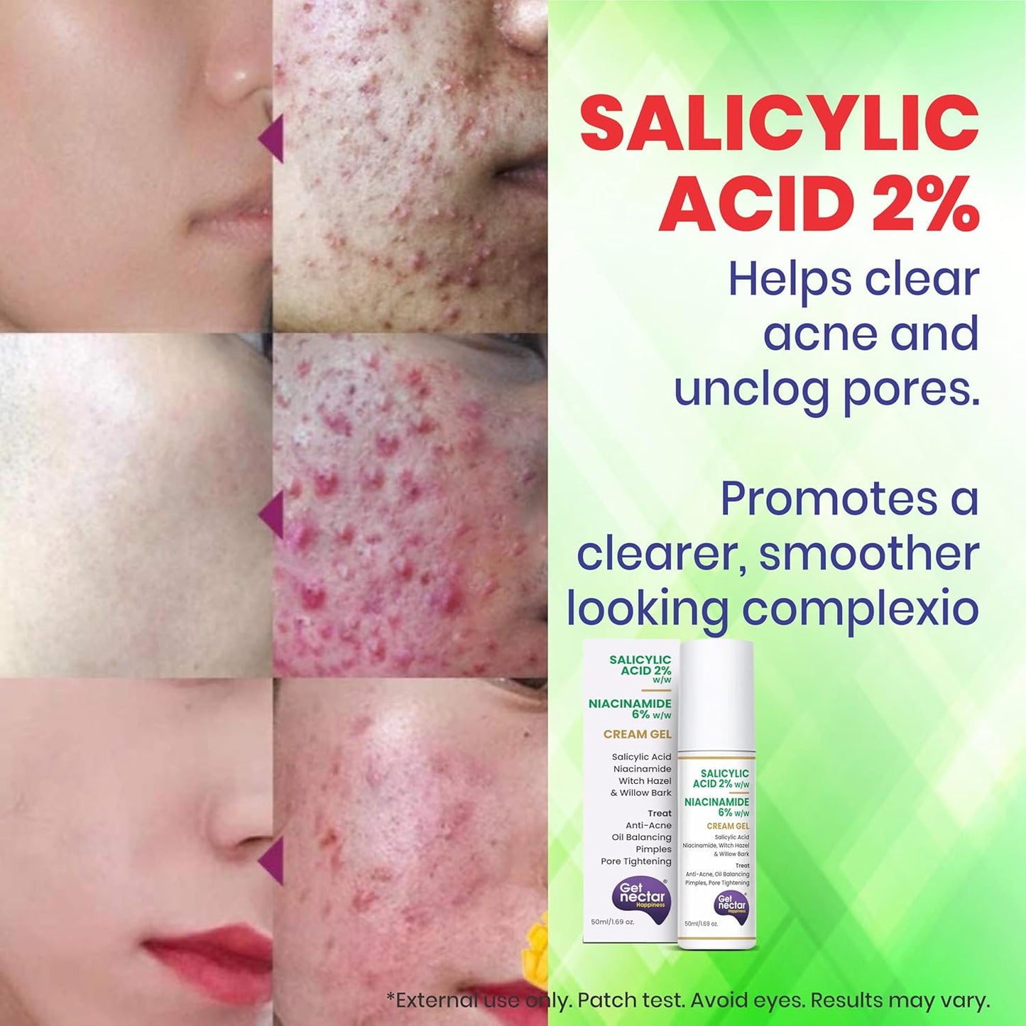 Get Nectar Happiness 2% Salicylic Acid 6% Niacinamide Acne Treatment Gel with Oil-Free for Active Acne, Pimples Oil Balancing, Pore Tightening & Brightens and Smoothens 50ml
