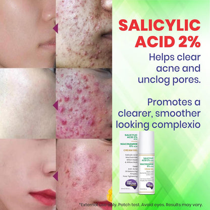 Get Nectar Happiness 2% Salicylic Acid 6% Niacinamide Acne Treatment Gel with Oil-Free for Active Acne, Pimples Oil Balancing, Pore Tightening & Brightens and Smoothens 50ml
