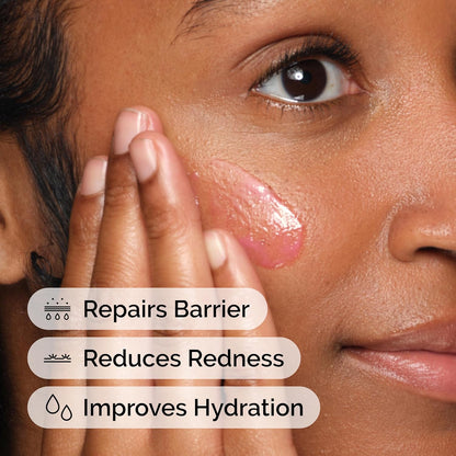 The Ordinary Soothing & Barrier Support Serum, Redness-Reducing & Hydrating Solution for Skin Barrier Recovery, 30ml