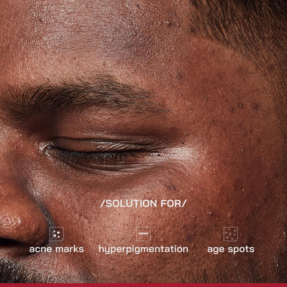 Proven Honest Derma /PHD/ 2% Alpha Arbutin Depigmentation Serum | Alpha Arbutin for Pigmentation & Dark Spot | Pigmentation serum for Women & Men | Tyrobrightâ„¢, Niacinamide | Tan removal | Fragrance-Free | 30ml