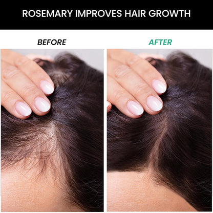 ThriveCo Rosemary Hair Conditioner | Helps Add Volume & Strengthen | With Pea Peptide & Caffeine | Densifying Formula for Fuller-Looking Hair | Paraben & Sulphate Free | For Men & Women | 250 ml