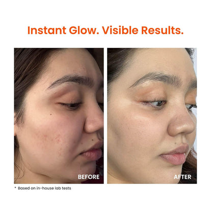 Foxtale Vitamin C Super Glow Moisturizer with Niacinamide & Peptides, Visibly Reduces Pigmentation, Enhances Skins Brightness Instantly, For All Skin Types, Women & Men - 50ml, Cream